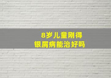 8岁儿童刚得银屑病能治好吗