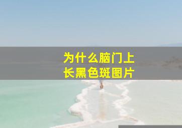 为什么脑门上长黑色斑图片