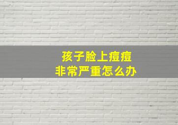 孩子脸上痘痘非常严重怎么办