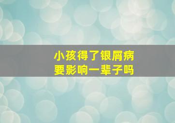 小孩得了银屑病要影响一辈子吗