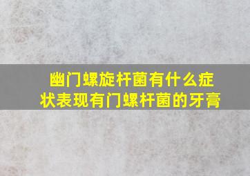 幽门螺旋杆菌有什么症状表现有门螺杆菌的牙膏