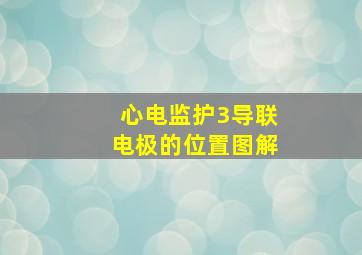 心电监护3导联电极的位置图解