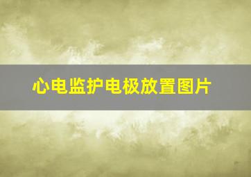 心电监护电极放置图片