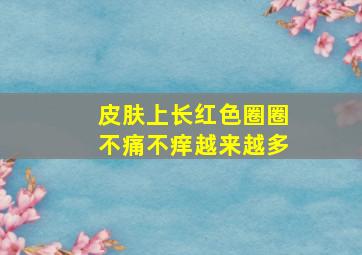 皮肤上长红色圈圈不痛不痒越来越多