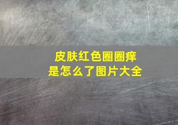 皮肤红色圈圈痒是怎么了图片大全