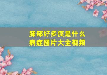 肺部好多痰是什么病症图片大全视频