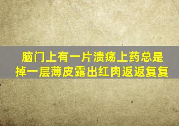 脑门上有一片溃疡上药总是掉一层薄皮露出红肉返返复复