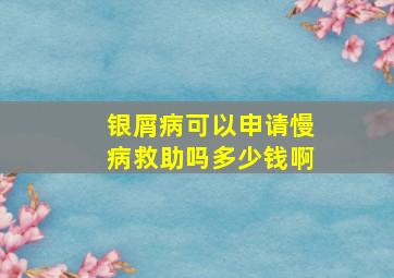 银屑病可以申请慢病救助吗多少钱啊