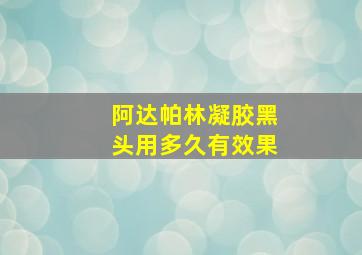 阿达帕林凝胶黑头用多久有效果